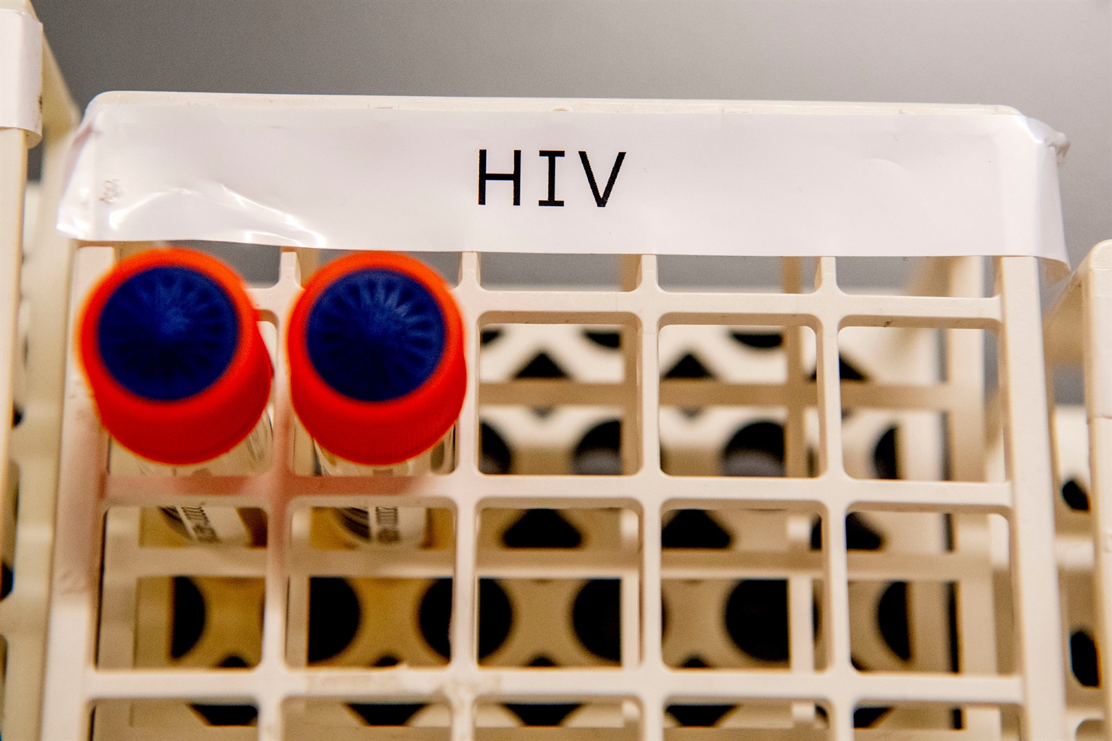 Blood samples from patients with HIV