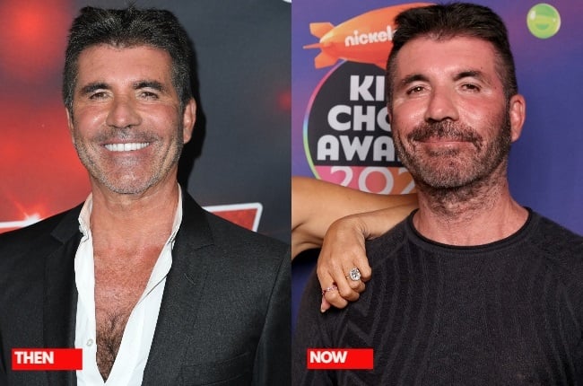 Simon Cowell turned heads recently when he arrived at the Nickelodeon Kids' Choice Awards (right) with a more natural appearance. (PHOTO: Getty Images) 
