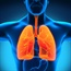 Keytruda may help fight tough-to-treat lung cancer