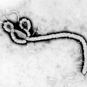 The Ebola virus, pictured here, causes disease that currently leads to death in 25 to 90 percent of cases. (Transmission electron micrograph image of Ebola virus, courtesy of the US Centers for Disease Control and Prevention.)