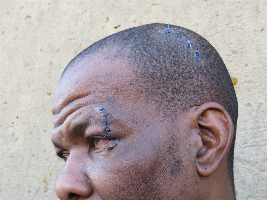 Sandile Nkosi said he was assaulted for something he didn't do. Photo by Ntebatse Masipa