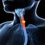 New therapeutic strategy for oesophageal disorder