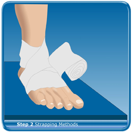 Strapping methods for ankle sprains | Health24