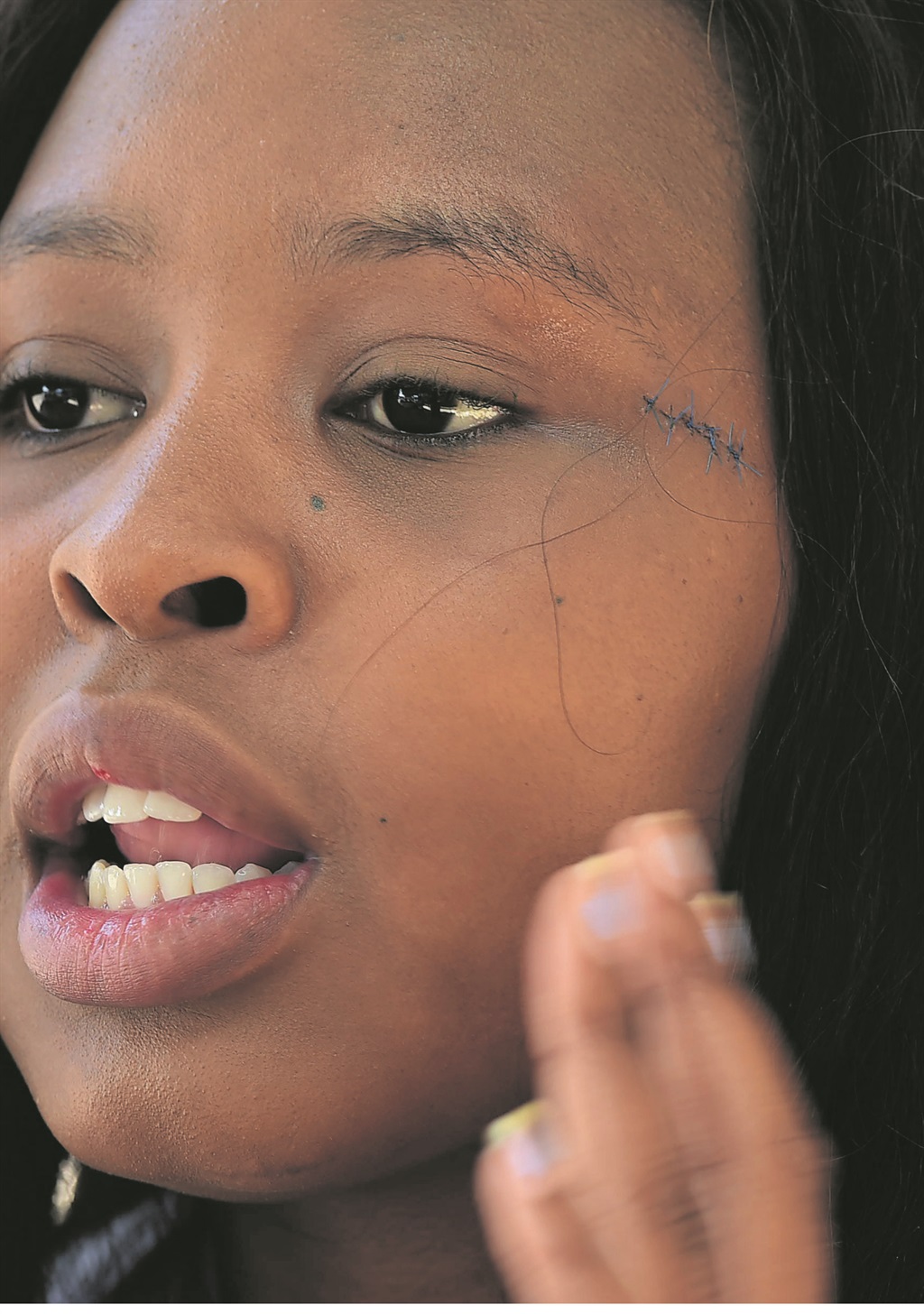Tehila Nothnagel (22) claimed she was assaulted by Dineo Ranaka.       Photo by Lucky Morajane 