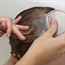 Toddler dies after DIY lice treatment 