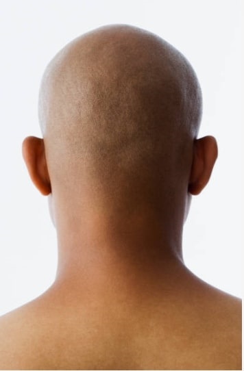 Bald men are said to be smarter