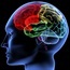 Brain injury may increase stroke risk
