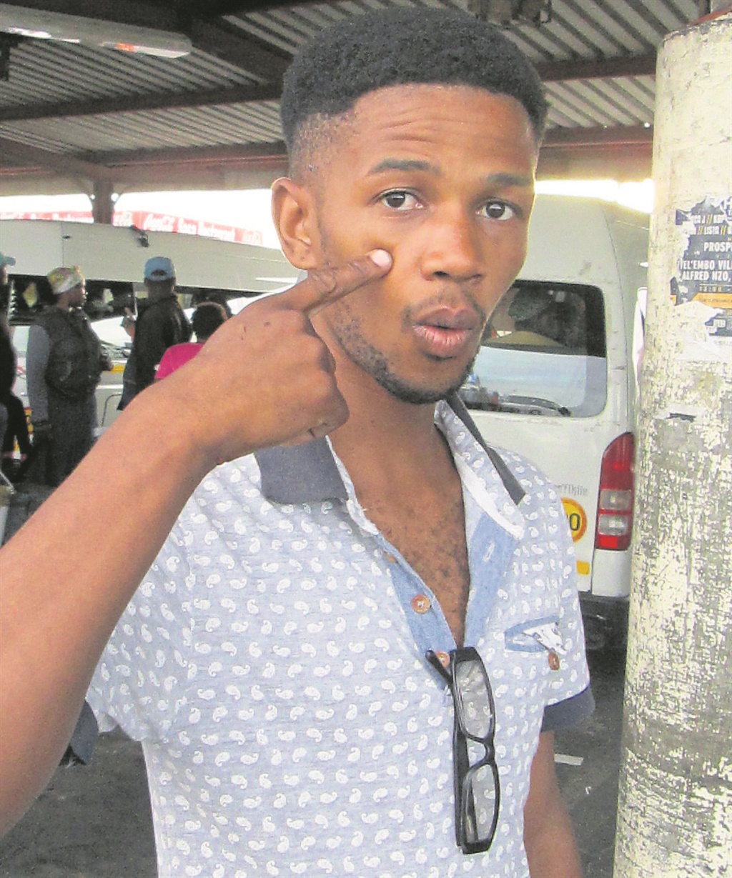 Gay activist Thando Dyamara (24) shows where he was allegedly slapped by the guard.                Photo by Vincent Lali 