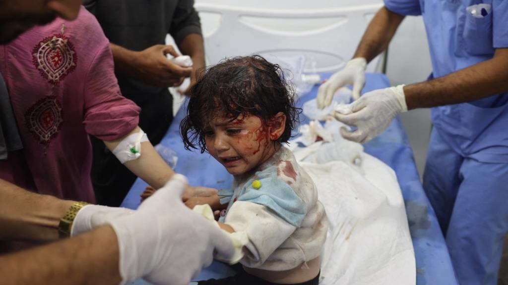 A Palestinian girl, wounded in an Israeli strike o