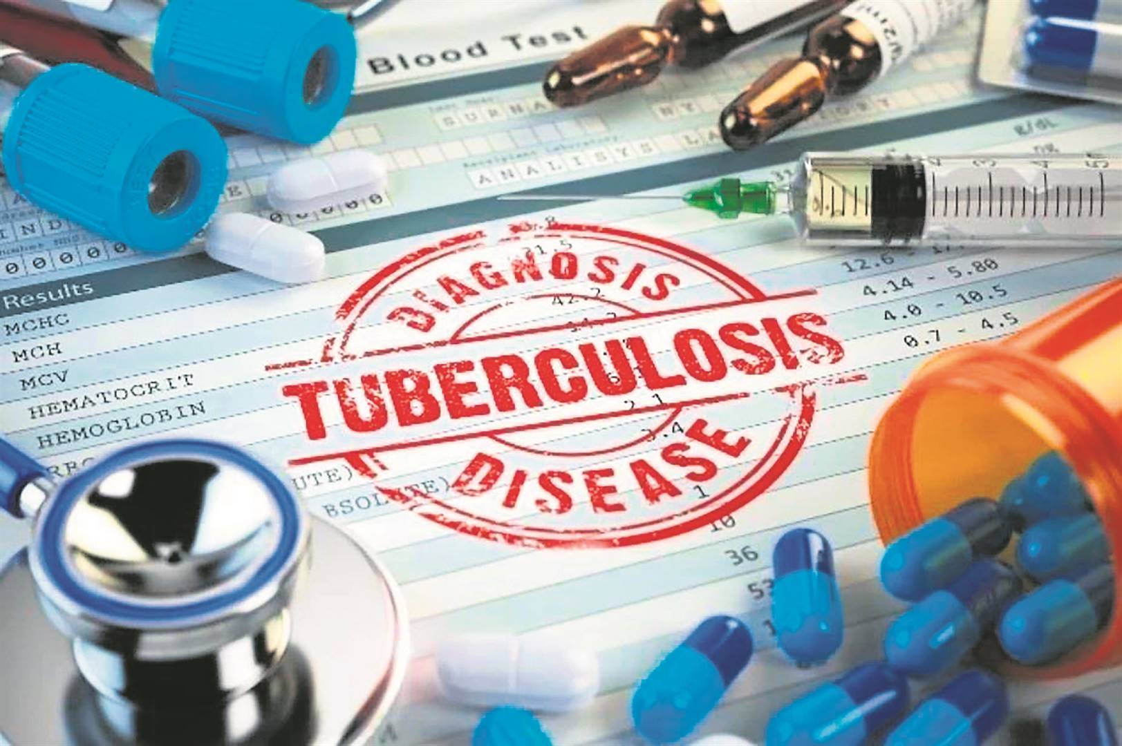 TB continues to be the leading cause of death in South Africa. (Getty Images)