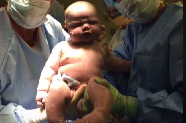 Baby J weighed a staggering 6,6kg and was 60cm long at birth. (Photo: TIK TOK) 
