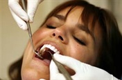 Cavities (dental caries)