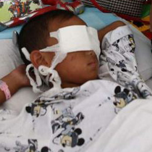 Chinese six-year-old Guo Bin will be getting "electronic eyes" after having his eyes gouged out in a cruel attack.