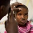 Cataracts main cause of blindness in SA children