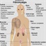 Signs and symptoms of fibromyalgia