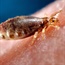 How similar are body lice to head lice?