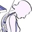 Posture changes due to osteoporosis