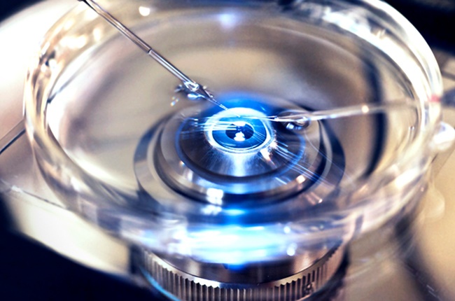 Sperm injected into egg. Photo: Getty Images