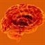 Multiple sclerosis drug may cause brain infection