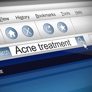 Searching for a cure for acne?