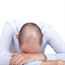 The bald facts about losing your hair