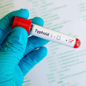 Typhoid is spread via faecal oral contamination. (iStock)