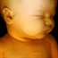 Size of foetus affects stillbirth risk