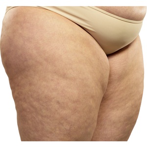 Woman showing her cellulite from Shutterstock