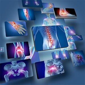 Points in the body where chronic pain often manifests