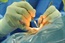 Cataract surgery may benefit people with dementia