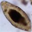 Ancient parasite highlights humans' role in spread of disease
