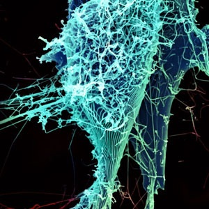 Ebola Virus Particles from Flickr Creative Commons.