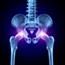 What is a bone scan and will it hurt?