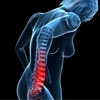 What is a herniated disc? 