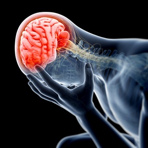 medical illustration - swollen, painful brain from Shuttershock
