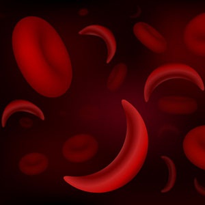 Red blood cells of sickle cell anaemia disease and normal cells from Shutterstock.