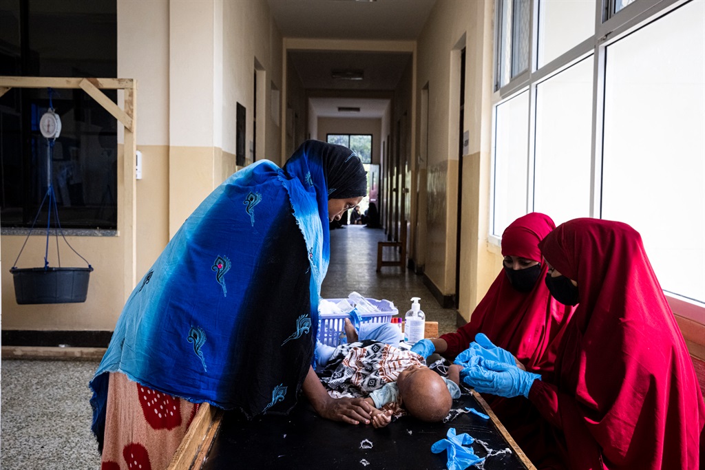 Nurses examine a severely malnourished baby in Banadir Maternity and Children Hospital in Mogadishu, Somalia.