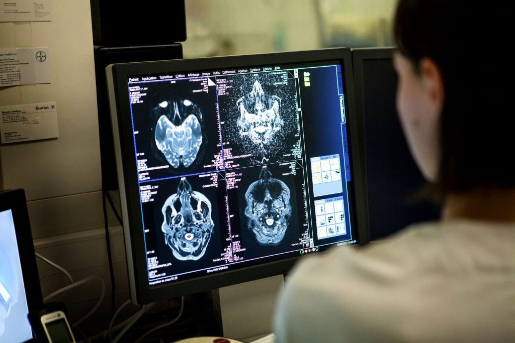 A technician monitors a brain MRI scan session.