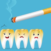What does smoking do to your teeth? An oral hygienist breaks it down