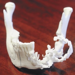 A replica of the 3D printed titanium jaw bone.