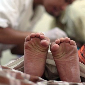 A boy's toes curl in pain as a doctor performs circumcision on him.  Photograph: Dita Alangkara/AP