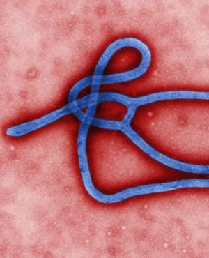An Ebola virus. (CDC, AP)