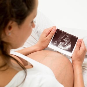 Pregnant woman looking at baby ultrasound scan from Shutterstock