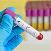 New HIV variant found in the Netherlands – progresses to Aids faster, but responsive to treatment