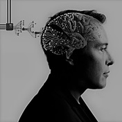 Elon Musk's Neuralink chip for human trials: Have all the concerns been addressed? 