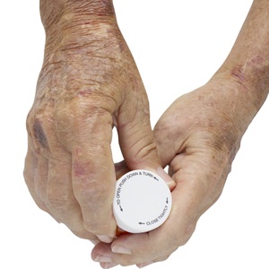 Elderly male with severe disfiguring rheumatoid arthritis from Shutterstock 