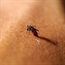 South Africa makes great progress in malaria control