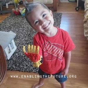 A young Hawaiian boy who recently received his prosthetic hand