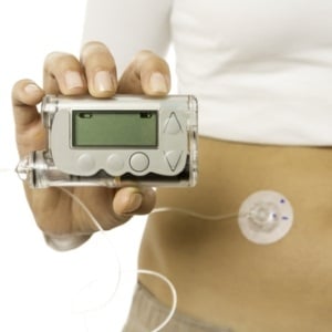 Insulin pump from Shutterstock