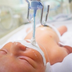 Baby on ventilator from Shutterstock